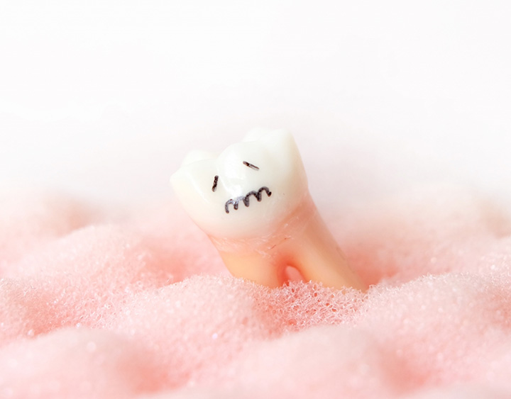 虫歯は自然治癒しないってご存知でしたか？
